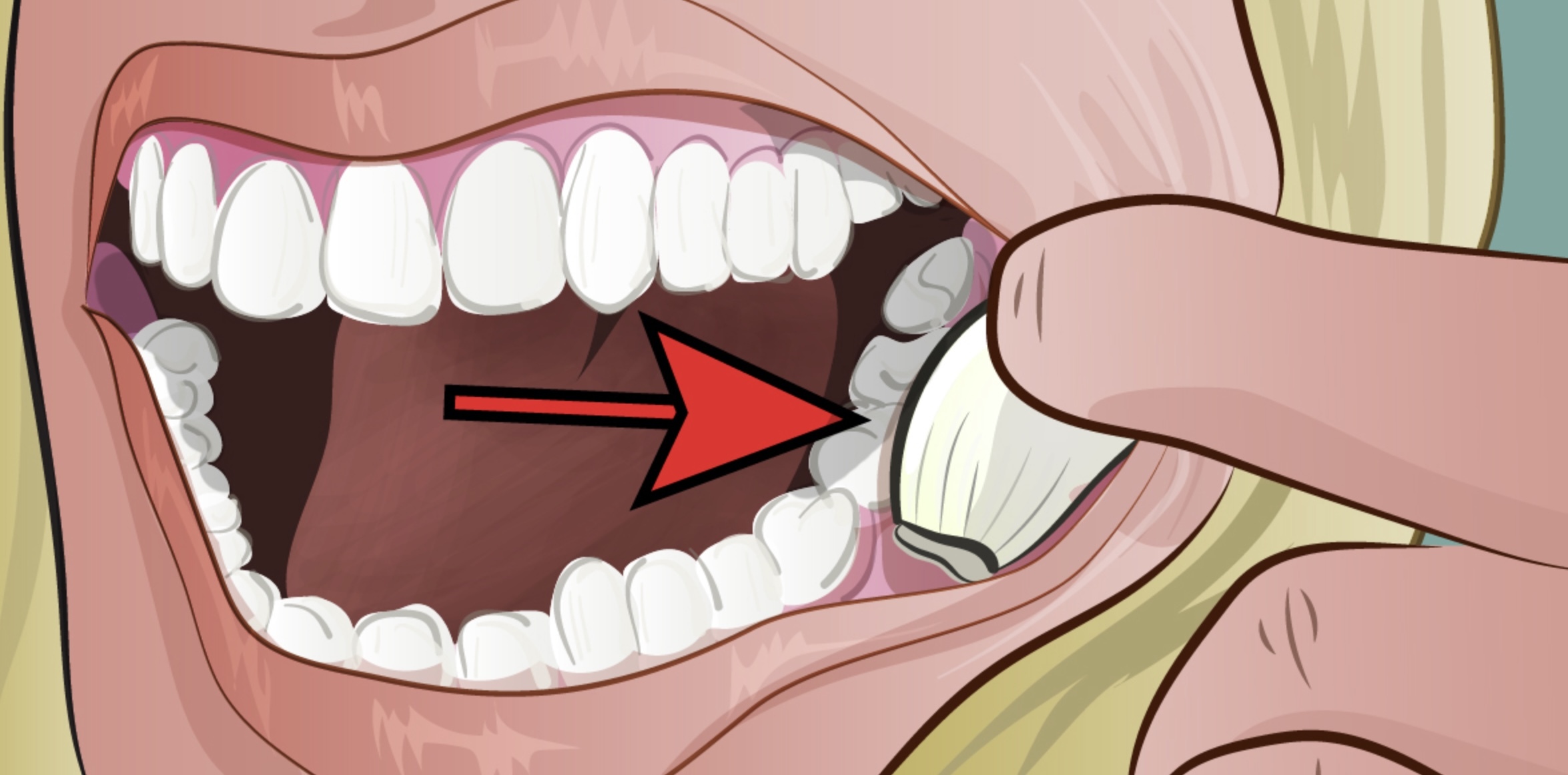 Knoblauch bei eingerissenen Mundwinkeln