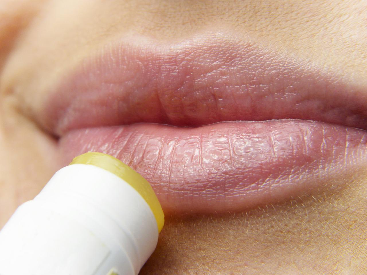 Lippenpflege bei eingerissenen Mundwinkeln