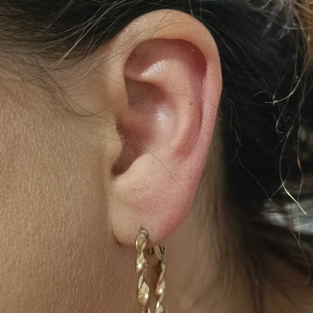Les oreilles qui démangent peuvent également être le signe d'une réaction allergique.